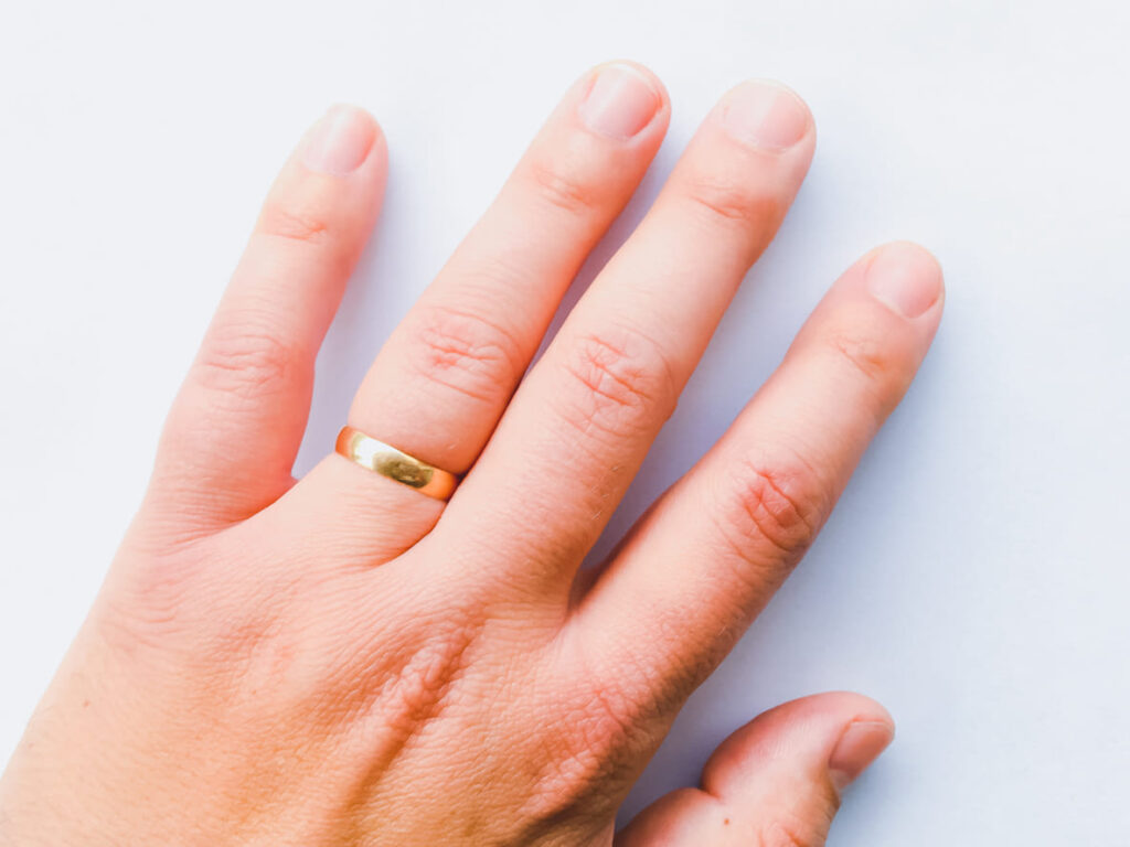 métodos para sacar un anillo de un dedo hinchado
